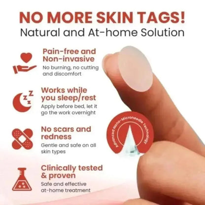 Acne Coverage Tag