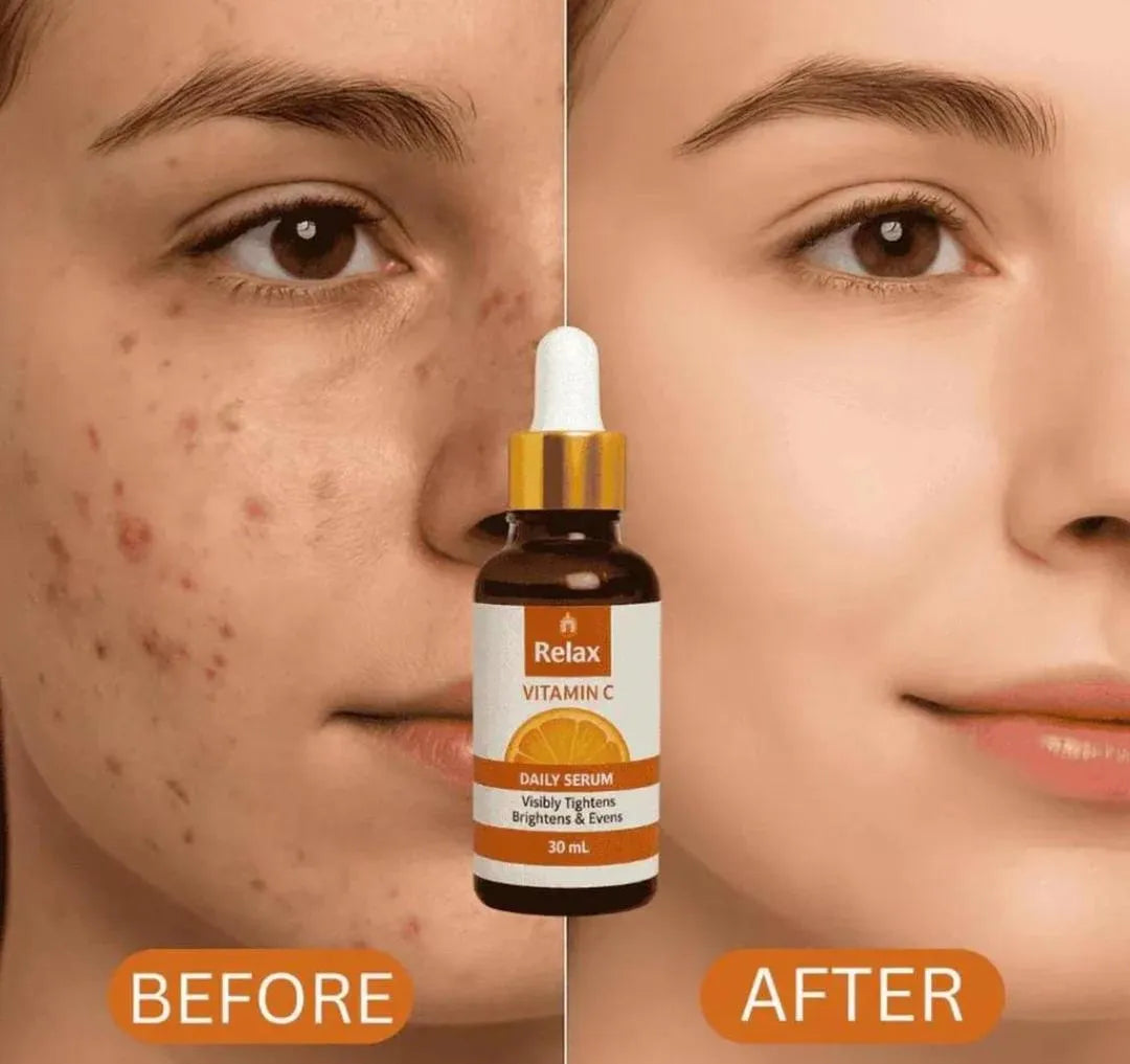 Whitening And Brightening Face Toner - 30ml Set Of 1 for All Skin Types