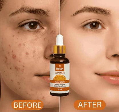 Whitening And Brightening Face Toner - 30ml Set Of 1 for All Skin Types