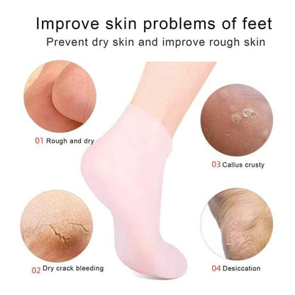Silicone Anti-Crack Moisturizing Socks for Feet